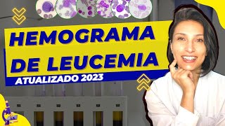 Hemograma Completo de Leucemia  ATUALIZADO 2023  Células Sanguineas  Biologia  Biomedicina [upl. by Anihcak570]