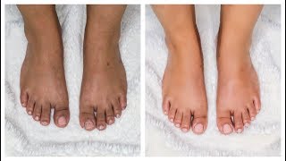 How to do PEDICURE at Home  Summer Ready Feet in Minutes [upl. by Laitselec]