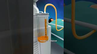 How Liposuction Works Quick Overview shorts  creativelearning3d [upl. by Kapoor]