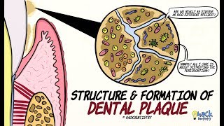 Dental Plaque Structure and Formation [upl. by Shields]