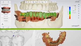 Projektowanie szablonu chirurgicznego  3Shape Implant Studio  GoodLab [upl. by Laeira909]