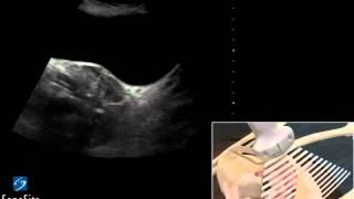 3D Cómo hacer Examen ecográfico de la Pelvis en Mujer  Ultrasonido SonoSite [upl. by Zindman159]