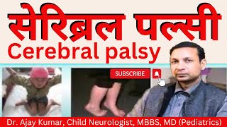 Cerebral Palsy  Dr Ajay Kumar Child Neurologist in Patna Call 7250023111 9546454005 [upl. by Four]