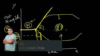 EDAIC essentials Thromboelastography [upl. by Seek]