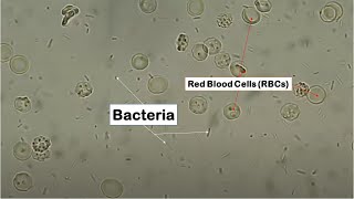 Red blood cells and Bacteria [upl. by Eyak]