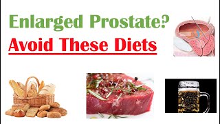 Foods to Avoid with Enlarged Prostate  Reduce Symptoms and Risk of Prostate Cancer [upl. by Zoe]