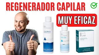 Tratamiento para la ALOPECIA  ✅ MUY EFECTIVO [upl. by Eille]