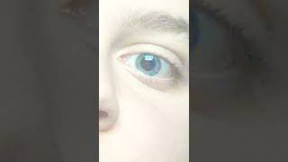 My Pupils Dilating  eyes eye foryou grayeyes fyp [upl. by Ahpla]