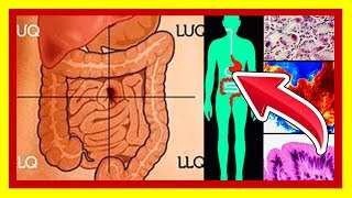 ✔ Significado de los Gruñidos en el Estomago  Causas de Ruidos INTESTINALES [upl. by Ciprian]