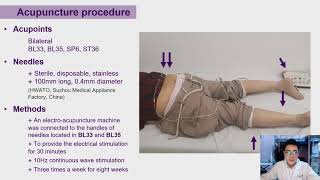 575 Is acupuncture an effective approach to manage neurogenic detrusor underactivity a single [upl. by Ojok]