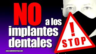 NO CAIGAS EN ESTE ERROR AL REPONER DIENTES CON IMPLANTES DENTALES PUEDES PERDERLO TODO [upl. by Huff]