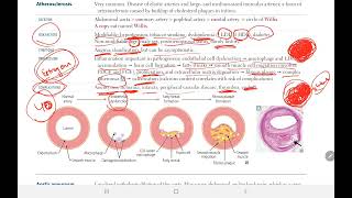 Arteriosclerosis 2  BACK BENCHERS ACADEMY [upl. by Enra]