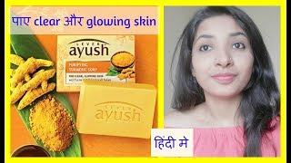 lever ayush PURIFYING TURMERIC SOAP for clear amp glowing skin REVIEW IN hindi [upl. by Fitts]