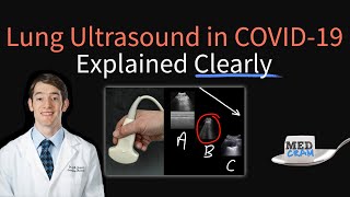 Lung Ultrasound in COVID 19 Findings Accuracy Pneumonia Diagnosis Utility POCUS [upl. by Nahpos]