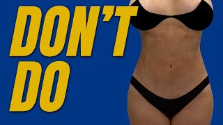 MY SMARTLIPO JOURNEY  WHAT TO EXPECT amp TIPS  Week 1  Before amp After  Mauricette Diaz [upl. by Utta130]