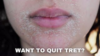 WATCH THIS BEFORE QUITTING RETINA  PURGING DRYNESS ACNE AND ANTIAGING [upl. by Pastelki974]