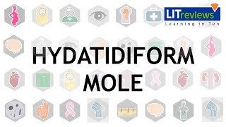 Hydatidiform Mole [upl. by Hayott]