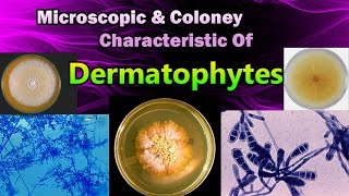 Morphology amp Colony Characteristic Of Dermatophytes [upl. by Allemap393]