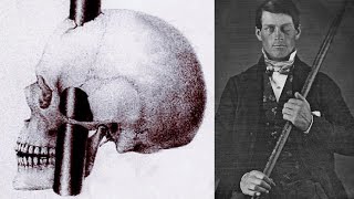 Man survives getting pierced in brain with iron rod The Curious Case Of Phineas Gage [upl. by Minni64]