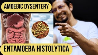 Amoebic dysentery  entamoeba histolytica  Cause diagnosis pathogenesis and treatment [upl. by Notna97]