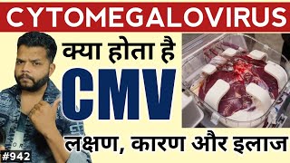 CMV Infection क्या होता है  Cytomegalovirus Explained In Hindi [upl. by Namref]