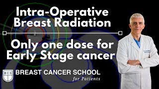 Breast Cancer IntraOperative Radiation IORT [upl. by Hakeem379]