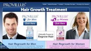 Provillus Reviews  Does Provillus Hair Growth Treatment Really Work [upl. by Chevalier]