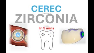 CEREC chairside Zirconia crown design in 3 mins [upl. by Adieno396]