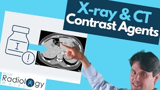 Contrast Agents in Xray and CT Scans What You Need to Know [upl. by Tnilc]