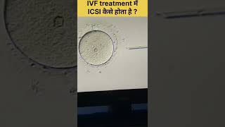 ICSI Procedure in IVF Intracytoplasmic sperm injection fertilitytreatment ivfjourney ivfsuccess [upl. by Acinaj]