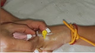 IV Cannulation 24G Cannula How To Insert IV CannulaIV Cannula Kaise Lagaye IV Cannula Insertion [upl. by Aloek]