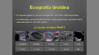 Tiroides Nódulo tiroideo y Cáncer de Tiroides [upl. by Danuloff911]