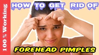 How To Get Rid Of Pimples On Forehead Overnight  Fast  Home Remedies  Blackheads  Acne  Remove [upl. by Amahs723]