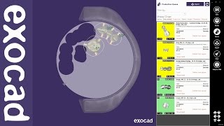 exocad Video Tutorial basic exocam [upl. by Nilats]