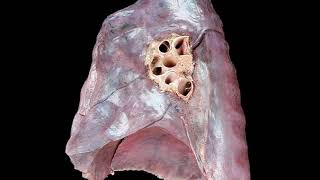 Aparato respiratorio 1 Pulmones generalidades [upl. by Heimer624]