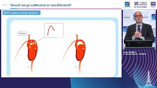 Xavier Monnet  Pulse contour analysis Should we go calibrated or uncalibrated [upl. by Hsekin338]