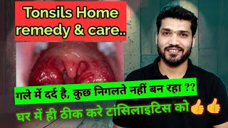 टॉन्सिलाइटिस घरेलू उपचार  Tonsillitis Home Remedies and care [upl. by Joselow]