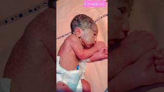 Newborn After Birth nicu baby medical viralshorts [upl. by Sabian789]