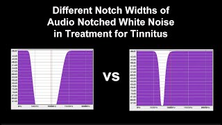 Notched Audio White Noise Sampler of Different Notch Widths in the Treatment for Tinnitus [upl. by Bilski]