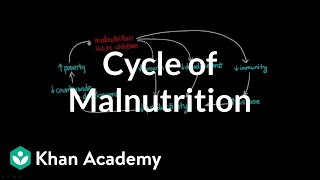 Cycle of Malnutrition [upl. by Aikemahs]