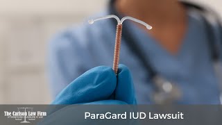 ParaGard Lawsuit  Copper IUD [upl. by Wanyen]