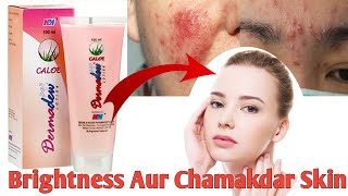 Dermadew Caloe Lotion hindi Review Iska Kam Kya Hai Side Effects Uses  benefits digitalmedilife [upl. by Nivar]