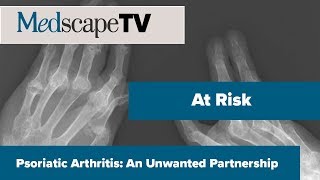 At Risk  Psoriatic Arthritis An Unwanted Partnership  MedscapeTV [upl. by Bernstein777]