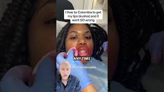 Lip Blushing GONE WRONG  Plastic Surgeon Reacts [upl. by Dahsraf]