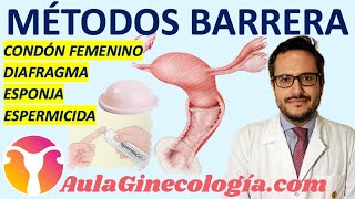 MÉTODOS ANTICONCEPTIVOS DE BARRERA PRESERVATIVO FEMENINO DIAFRAGMA  Ginecología y Obstetricia [upl. by Eirojam346]