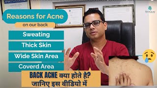 What is back acne  Causes of back acne  Body Acne  All about acne  Dr Jangid [upl. by Jobye]