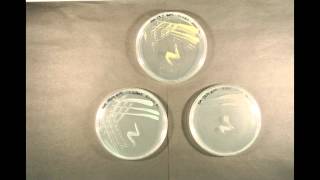 Bacterial Growth time lapse [upl. by Lovato]