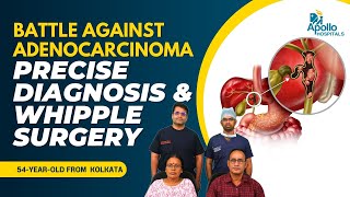 54YearOld Defeats Complicated Adenocarcinoma With Whipple Surgery  Bile Duct Cancer Treatment [upl. by Spearman]