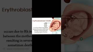 Erythroblastosis fetalis biology ncert bloodgroup shorts bodyfluids bloodpressure rhfactor [upl. by Dualc501]