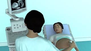 The Basic Steps of an Obstetric Ultrasound Examination [upl. by Remled110]